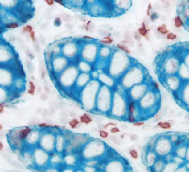 Colon Cytokeratin Amec Red Hrp Substrate