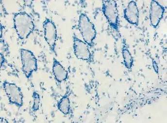 Endogenous Alkaline Phosphatase Solution Treated Tissue