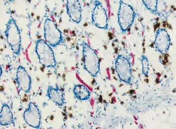 Endogenous Alkaline Phosphatase Brown