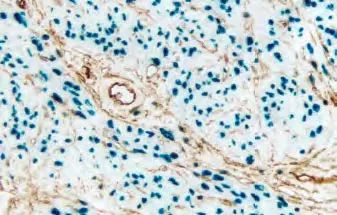 Endometrium Substrate Brown
