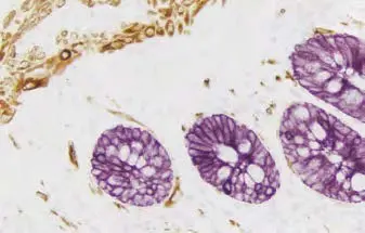 Intestine Substrate Purple