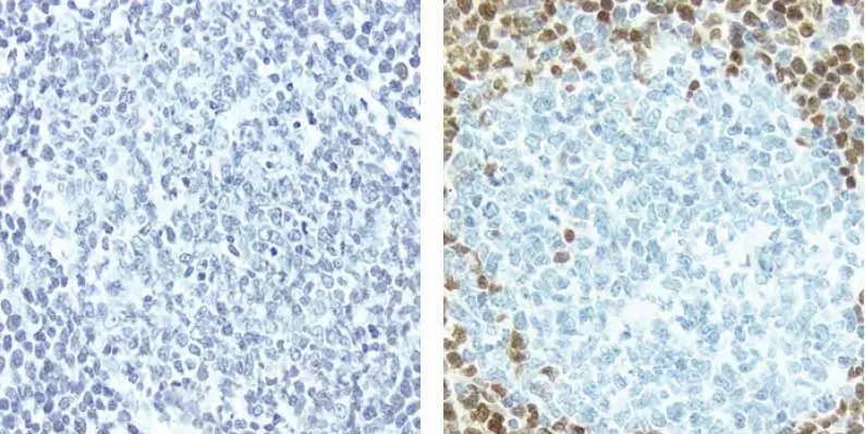 Lymph Node Blue Brown