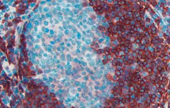 Mouse Tonsil Blue