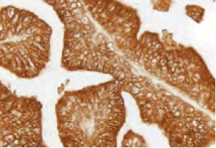 Prostate Prostate Specific Antigen Brown