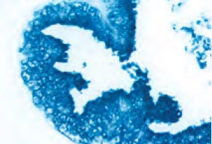Prostate Prostate Specific Antigen Indigo