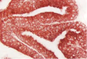 Prostate Prostate Specific Antigen Red