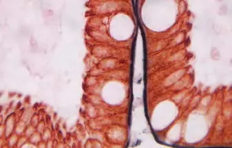 Small Bowel Novared