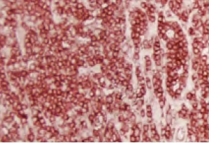 Tonsil Lca Red