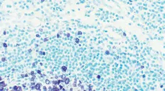 Tonsil Counterstain Green