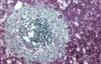 Tonsil Substrate Blue Gray