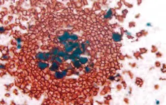 Tonsil Substrate Red