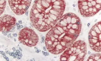 Colon Amec Red