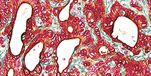 Immuno Img