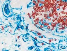 Multiple Antigen Label Colon2