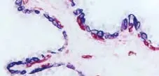 Prostate Red