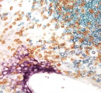 Tonsil Vector Vip Purple