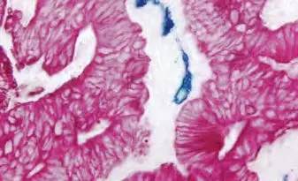 Tumor Red Ap Substrate