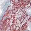 Prostate: Smooth muscle actin (m), ImmPRESS Anti-Mouse Ig Kit, AEC Substrate Kit (red). Hematoxylin QS counterstain (blue). Mounted in VectaMount AQ Mounting Medium.