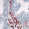 Prostate: Smooth muscle actin (m), ImmPRESS Anti-Mouse Ig Kit, AEC Substrate Kit (red). Hematoxylin QS counterstain (blue). Mounted in VectaMount AQ Mounting Medium.