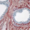 Prostate: Smooth muscle actin (m), ImmPRESS Anti-Mouse Ig Kit, AEC Substrate Kit (red). Hematoxylin QS counterstain (blue). Mounted in VectaMount AQ Mounting Medium.