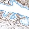 Breast: CD34 (m), ImmPRESS Anti-Mouse Ig Kit, DAB Substrate Kit (brown). Hematoxylin counterstain (blue).