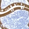 Small Bowel: Cytokeratin 8/18 (m), ImmPRESS Anti-Mouse Ig Kit, DAB Substrate Kit (brown), Hematoxylin QS (blue).