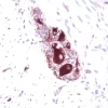 Small Bowel: Peripherin (m), ImmPRESS Anti-Mouse Ig Kit, Vector NovaRED Substrate Kit (red). Hematoxylin QS Counterstain (blue).