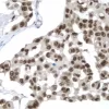 Breast: p53 (rp), ImmPRESS Anti-Rabbit Ig Kit, DAB Substrate Kit (brown). Hematoxylin QS counterstain (blue).