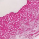 Tonsil: Cytokeratin Ae1/Ae3 (M), Immpress-Ap Reagent,
