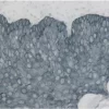 Tonsil: Cytokeratin AE1/AE3 (m), ImmPRESS Reagent (HRP), ImmPACT SG (blue-gray).
