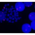 Fluorescence In Situ Hybridization Of Human Chromosomes Using 5' Endtag Texas Red-Labeled Phur 98 Detected Directly And Mounted In Vectashield Mounting Media With Dapi.