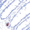 Colon: Peripherin (m, VP-P968), ImmPRESS Anti-Mouse Ig Kit, ImmPACT NovaRED (red) substrate. Hematoxylin QS (blue) counterstain.