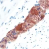 Colon: PGP 9.5 (m, VP-P983), ImmPRESS Anti-Mouse Ig Kit, ImmPACT AEC (red) substrate. Hematoxylin QS (blue) counterstain.