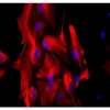 Astrocytes: Stained for GFAP and detected with Dylight 488 labeled secondary antibody. Mounted in VECTASHIELD HardSet Mounting Medium with DAPI. Image courtesy of Dr Emma East, Department of Life Sciences, The Open University, U.K.*