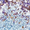 Tonsil triple stained using the VECTASTAIN Universal Elite ABC Kit: T cells (brown, DAB), B cells (purple, Vector VIP), epithelium (blue/gray, Vector SG).