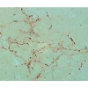 Nigrastriatal terminals: iontophoretically injected PHA-L (brown, Vector DAB).