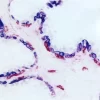 Prostate (double label): Cytokeratin (m), VECTASTAIN ABC-AP Kit, Vector Blue (blue) substrate. CD34, VECTASTAIN ABC-AP Kit, Vector Red (red) substrate.