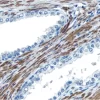 VECTASTAIN® Universal Quick HRP Kit, Peroxidase (Concentrate)