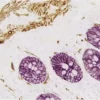 Intestine : Desmin (m), VECTASTAIN Elite ABC Kit, ImmPACT DAB (brown) substrate. Cytokeratin (m), VECTASTAIN Elite ABC Kit, Vector VIP (purple) substrate.