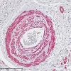 Lung: aSMA (mouse mab), ImmPRESS-AP Anti-Mouse Ig, ImmPACT Vector Red Substrate. Image kindly provided by the Centre for Inflammation and Tissue Repair, University College London.
