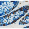 Human Colon: Mouse Anti-Ki67, ImmPRESS-HRP Anti-Mouse IgG, ImmPACT DAB EqV and Rabbit Anti-Cytokeratin ImmPRESS-AP Anti-Rabbit IgG, Vector Blue. Mounted in VectaMount Express Mounting Media