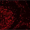 Tonsil: Ki67 (rb) detected with VectaFluor Excel Amplified Kit, Anti-Rabbit IgG, DyLight 594 (red). Mounted in VECTASHIELD® HardSet™ Antifade Mounting Medium.