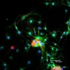Dorsal root ganglia cells (neurons and satellite glia) - double label. BIII tubulin, DyLight 549 labeled secondary antibody (orange). S100, DyLight 488 labeled secondary antibody (green). Mounted in VECTASHIELD HardSet Mounting Medium with DAPI.