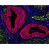 Human Uterine section (FFPE): Stained for Desmin (green) and Cytokeratin (red) using VectaFluor™ Duet Double Labeling Kit (DK-8828), and vasculature using DyLight® 649 UEA I lectin (purple). Mounted in VECTASHIELD® Vibrance™ with DAPI (blue)