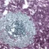 Tonsil (double label): CD3 (m), VECTASTAIN Universal Elite ABC Kit, Vector VIP substrate (purple); CD20 (m), VECTASTAIN Universal Elite ABC Kit, Vector SG substrate (blue/gray).