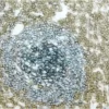 Tonsil (double label): CD3 (m), VECTASTAIN Universal Elite ABC Kit, Vector DAB substrate (brown); CD20 (m), VECTASTAIN Universal Elite ABC Kit, Vector SG substrate (blue/gray).