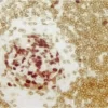 Tonsil (double label): Cyclin A (m), VECTASTAIN Universal ABC-AP Kit, Vector Red substrate (red); CD3 (m), VECTASTAIN Universal Elite ABC Kit, Vector DAB substrate (brown).