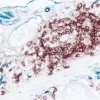 Colon (double label): CD34 (m), VECTASTAIN Universal ABC-AP Kit, Vector Blue substrate (blue); CD20 (m), ImmPRESS Universal Reagent, Vector NovaRED substrate (red).