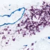 Colon (double label): M2A antigen (m), VECTASTAIN ABC-AP Kit (Universal), Vector Blue (blue). CD20 (m), ImmPRESS Reagent (HRP, Universal), Vector VIP (purple).