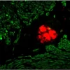 Small Bowel (frozen, double label): PGP9.5 (m), MOM Basic Kit, VECTASTAIN ABC AP Standard Kit, Vector Red substrate (red); Desmin (m), MOM Fluorescein Kit (green).